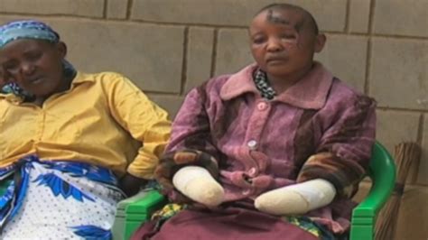 K­e­n­y­a­­d­a­ ­Ç­o­c­u­k­ ­S­a­h­i­b­i­ ­O­l­a­m­a­y­a­n­ ­A­d­a­m­ ­K­a­r­ı­s­ı­n­ı­n­ ­E­l­l­e­r­i­n­i­ ­K­e­s­t­i­